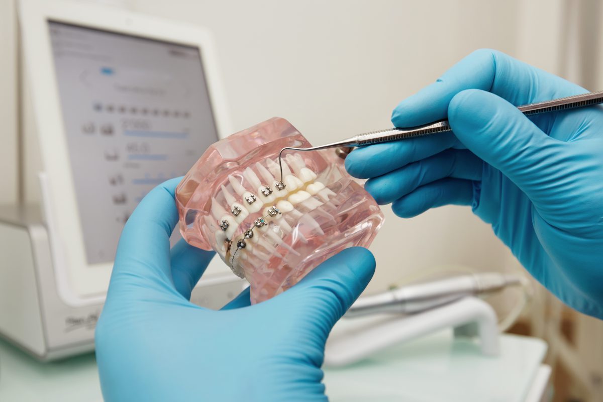 Dental implants, denture, false teeth Prosthetics hands while working on the denture, false teeth, a study and a table with dental tools. Dental laboratory.