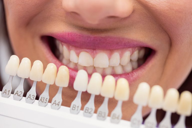 רופא שיניים בודק מטופלת עם גווני שיניים במרפאות שיניים באיסטנבול
