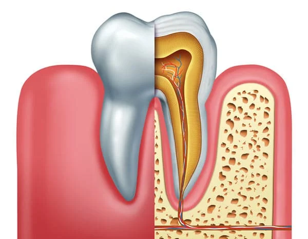 علاج قناة الجذر في عيادات اسطنبول لطب الأسنان