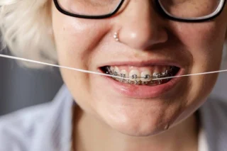 una-mujer-joven-con-brackets-se-cepilla-los-dientes-estambul-clinicas-dentales
