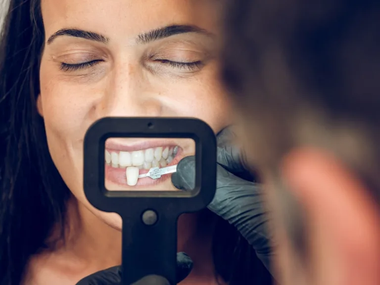 dentista-puede-tokman-recogiendo-muestra-de-dientes-carilla-para-mujer-paciente
