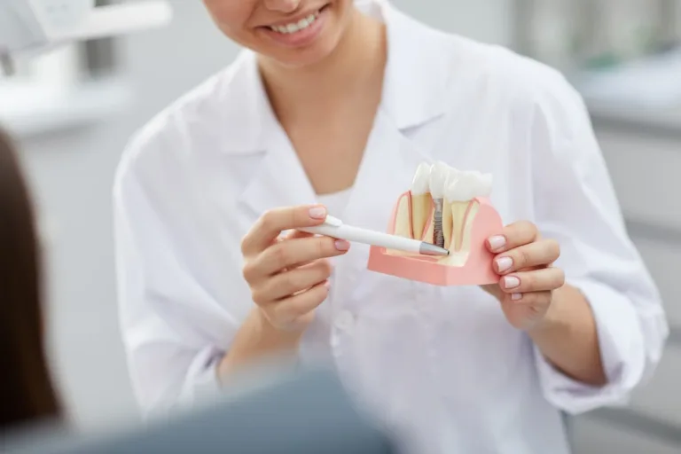 dentista explicando el proceso de implantación del diente clínicas dentales de estambul mejor dental en turquía carillas laminado de sonrisa de hollywood